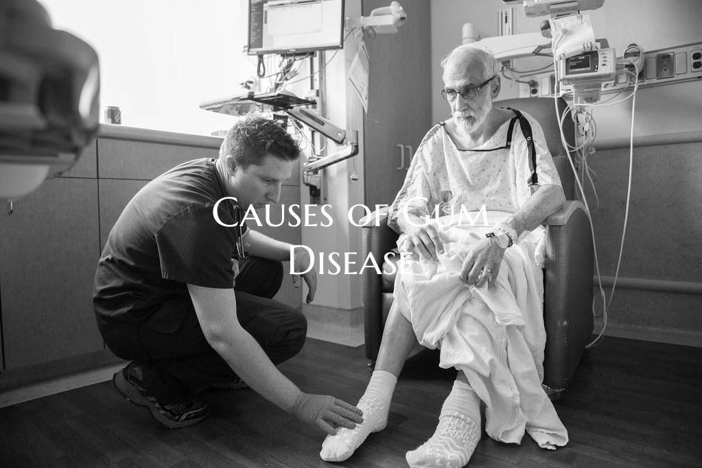 Causes of Gum Disease