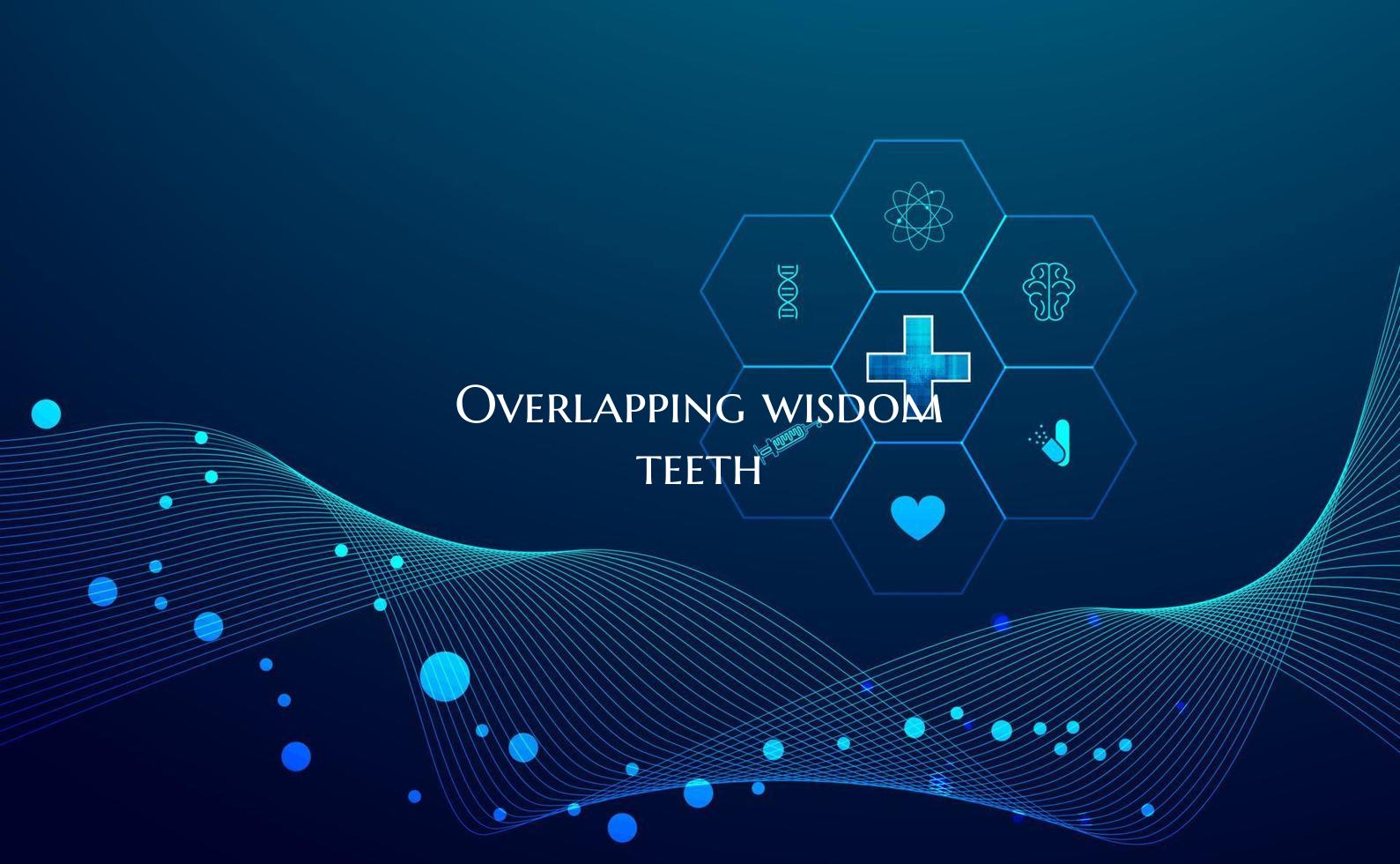 Overlapping wisdom teeth
